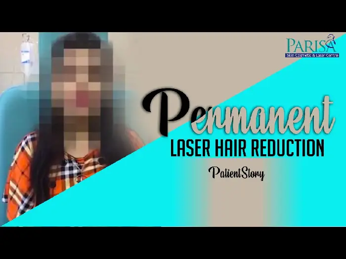 Laser Facial Hair Removal