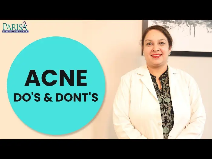 Do's & Don'ts for Acne Prone Skin